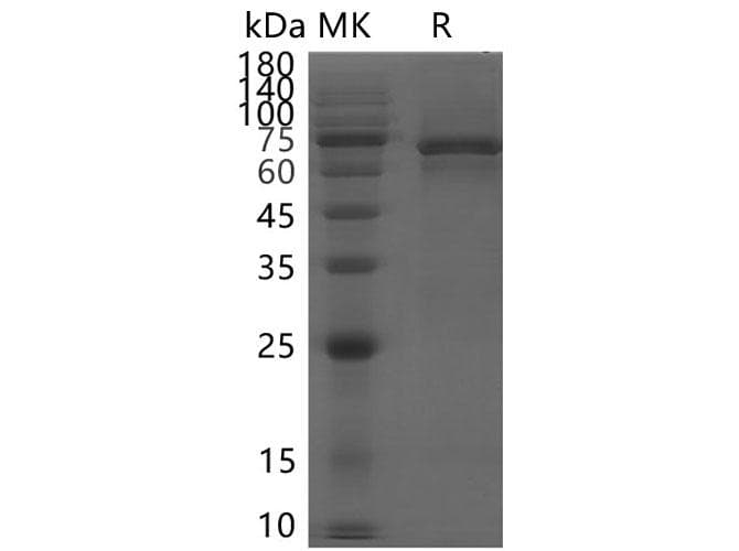 Coronavirus SARS-CoV-2 NSP13 (Helicase) protein (Recombinant His, N-terminus)