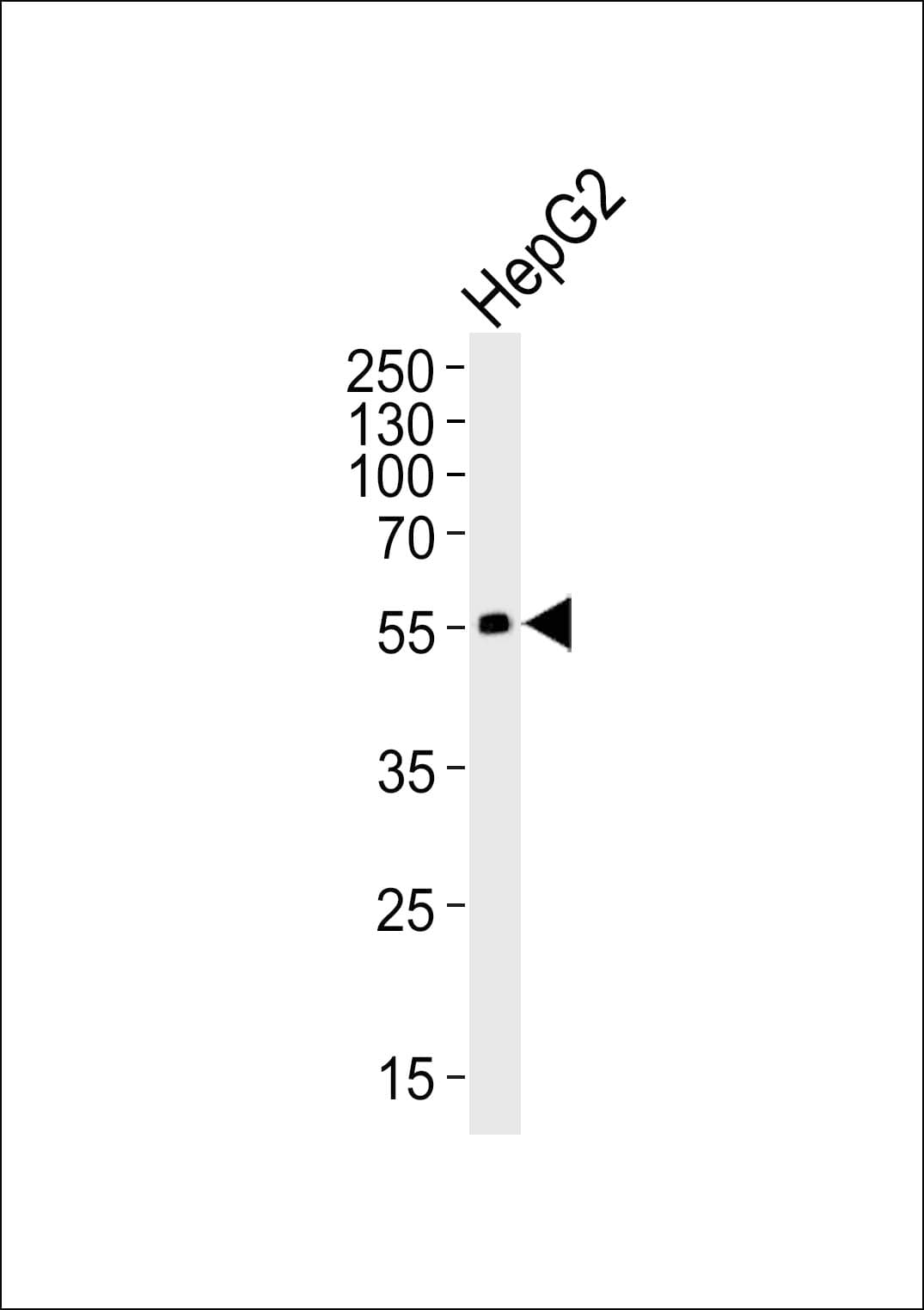 Polyclonal Rabbit anti-Human ADRB2 Antibody (Ser364, IHC, WB)