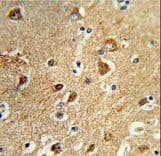 PPM1H Antibody (aa235-263)