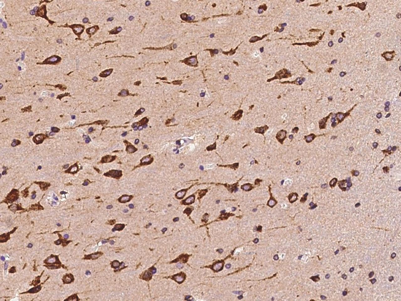 Polyclonal Rabbit anti-Human PCYOX1L Antibody (IHC)