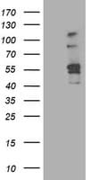 ALDH3A2 Antibody (clone OTI1H10)