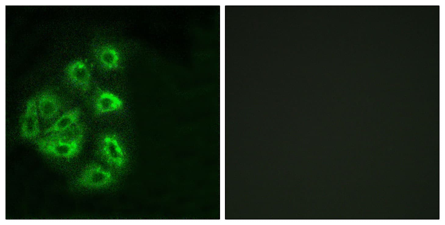 PI3K Alpha+Gamma Antibody (Internal)