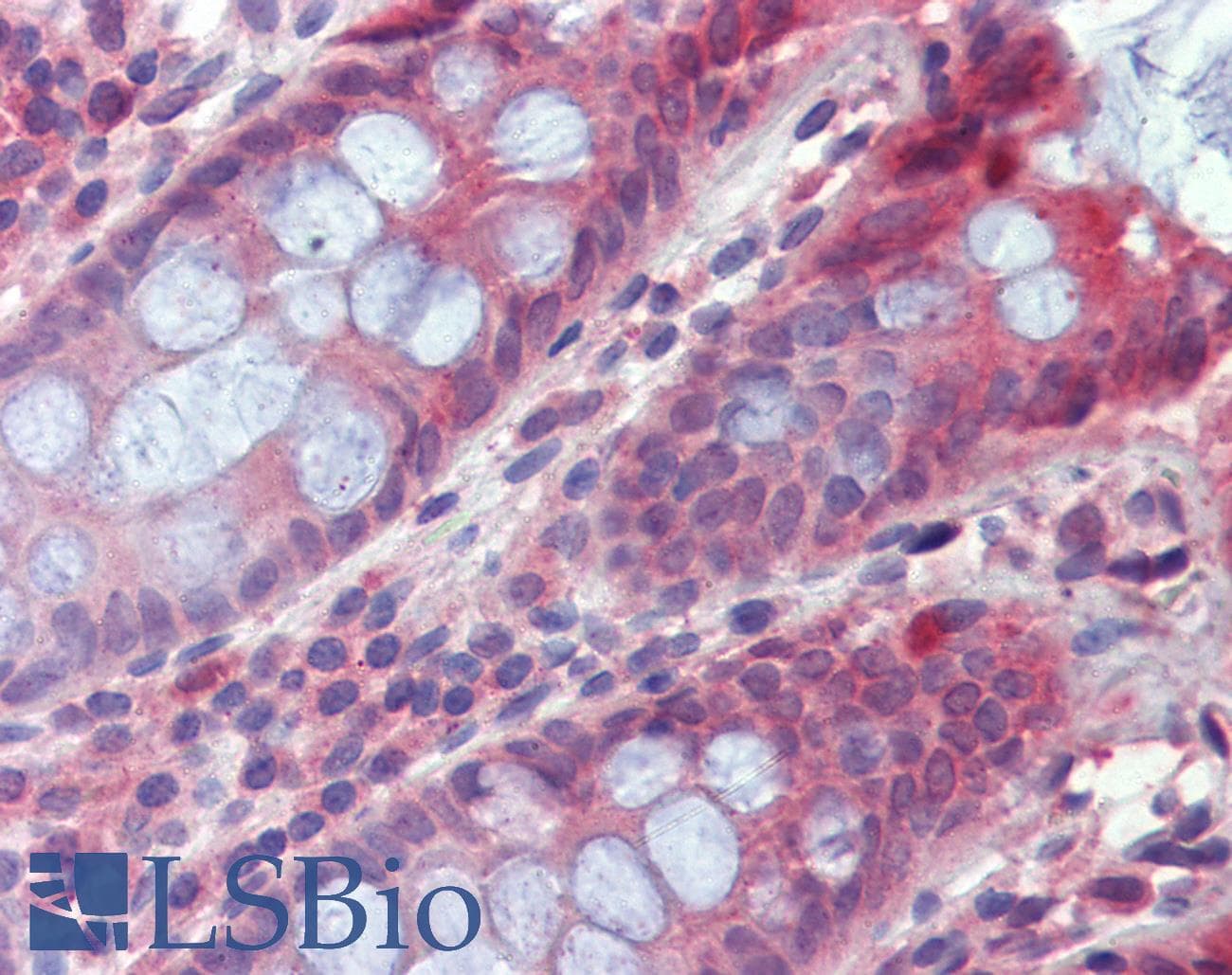 IHC-plus™ Polyclonal Goat anti-Human TPC2 / TPCN2 Antibody (aa735-747, IHC)