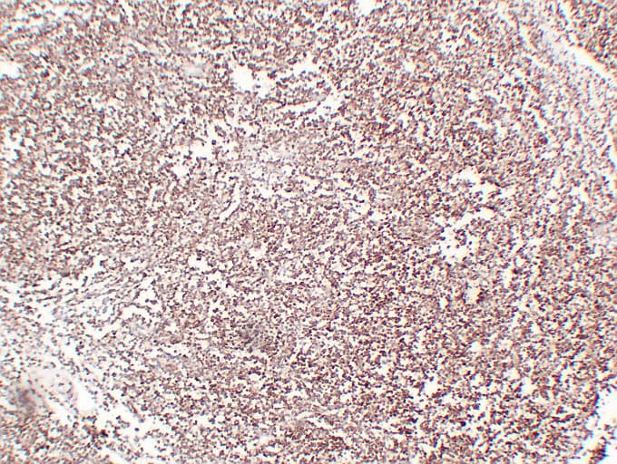 Monoclonal Mouse anti-Human CD1A Antibody (clone ABT-CD1a, IHC)
