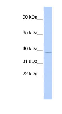 TSFM Antibody (aa144-193)