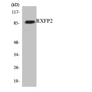 RXFP2 / LGR8 Antibody (aa103-152)