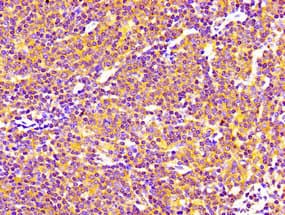 SIPA1 Antibody