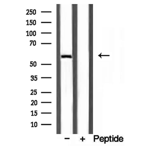 Polyclonal Rabbit anti-Human D2HGDH Antibody (IHC, WB)