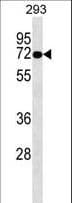 OTOP2 Antibody (aa336-363)