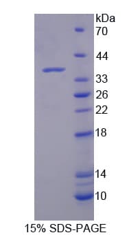 Mouse NUP214 / CAN Protein (Recombinant His)