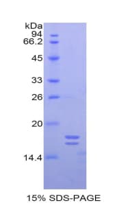 Human Glycocalicin Protein (Recombinant His)