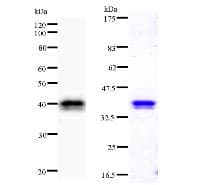CHD1L Antibody (clone 2170C3a)