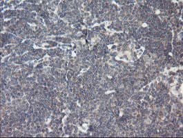 RIPK1 / RIP Antibody (aa133-422, clone OTI2D6, Carrier-free)