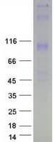 Human WFS1 Protein (Recombinant Myc-DDK (Flag))
