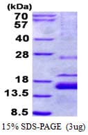 Human XAGE1 Protein (Recombinant His)