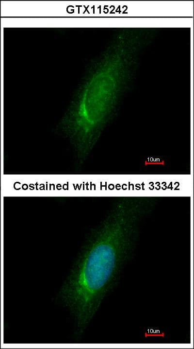 HOMER3 / Homer 3 Antibody (aa55-305)