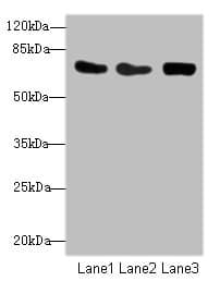 CSRNP2 / FAM130A1 Antibody