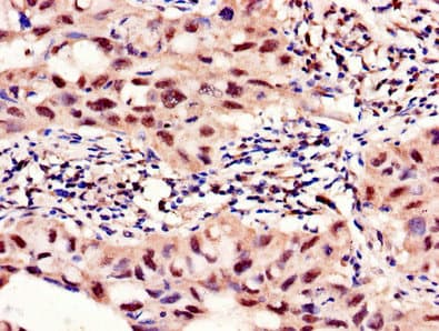 PFKFB2 Antibody