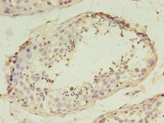 Polyclonal Rabbit anti-Human SPANXD Antibody (IHC)