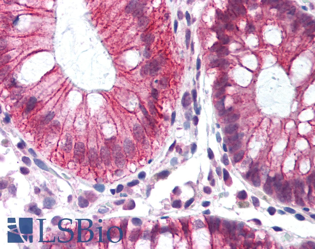 IHC-plus™ CTNNB1 / Beta Catenin Antibody (aa43-62)