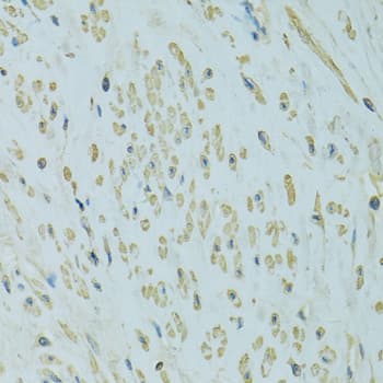 UGT1A6 Antibody
