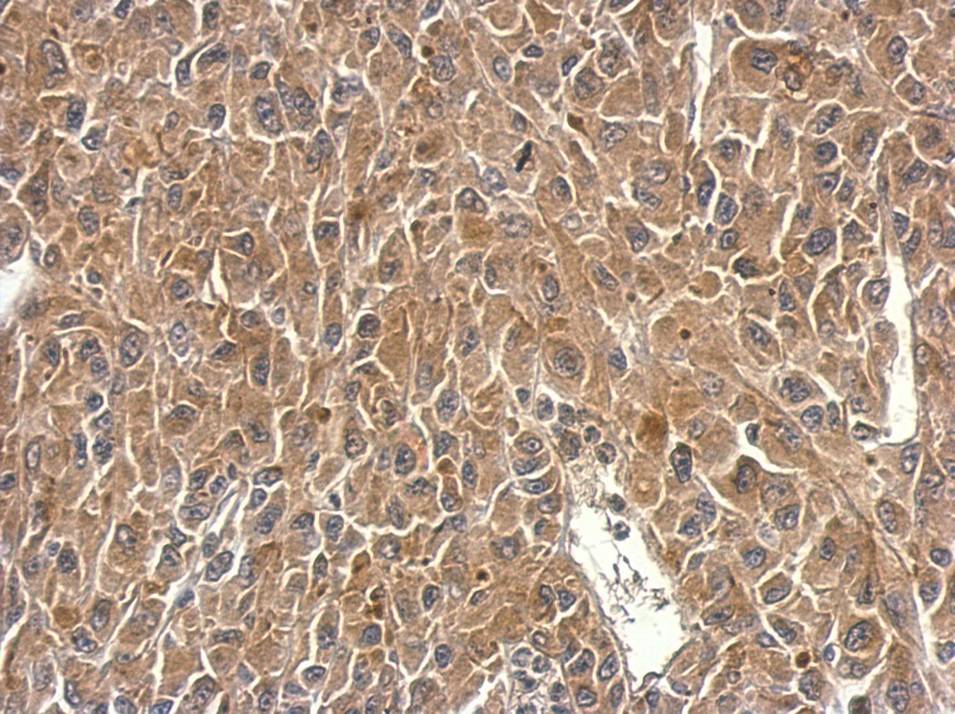 Polyclonal Rabbit anti-Human SH3BP1 Antibody (aa639-701, IHC, WB)