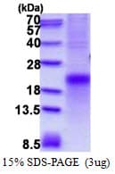 Human TNFRSF1A / TNFR1 Protein (Recombinant His)