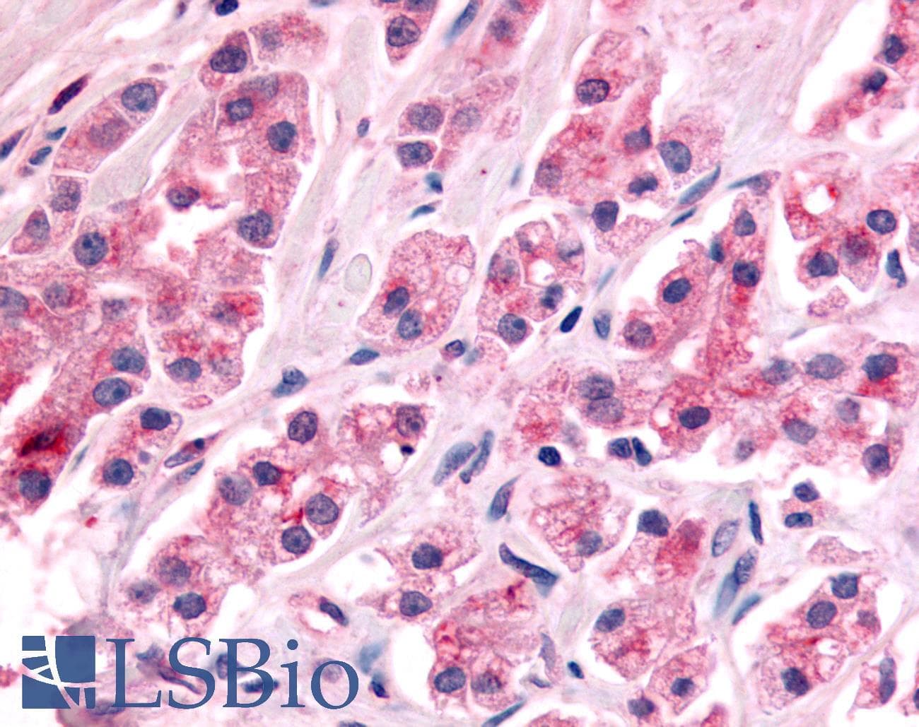 PathPlus™ Nor-1 / NR4A3 Antibody (C-Terminus)