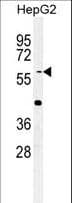 SLC7A6 Antibody (aa487-515)