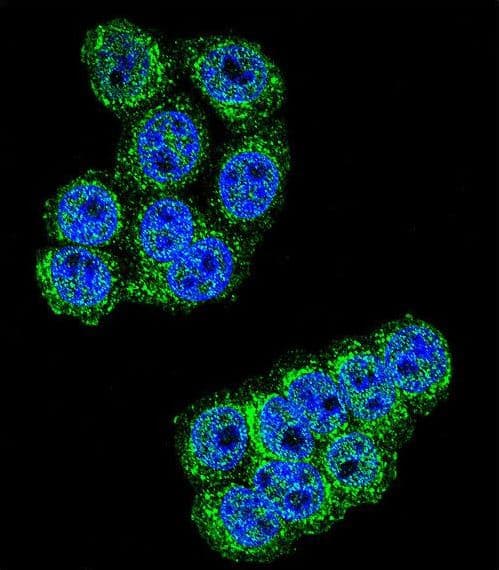 Dipeptidyl Peptidase 3 / DPP3 Antibody (aa583-612)
