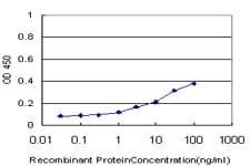 IHC-plus™ PIP4K2A / PIPK Antibody (clone 3A3)