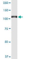 GRM6 / MGLUR6 Antibody (clone 1A11)
