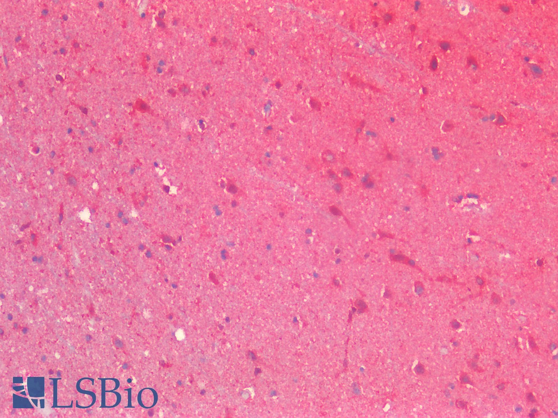 PathPlus™ CRBN / Cereblon Antibody