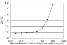 LCN1 / Lipocalin-1 Antibody (clone 1B11)