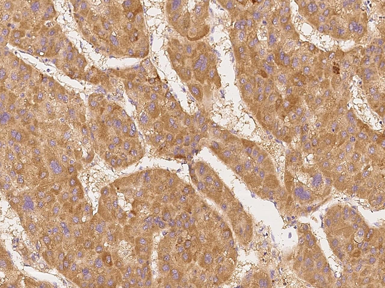 Polyclonal Rabbit anti-Human CDK11B / CDC2L1 Antibody (IHC)