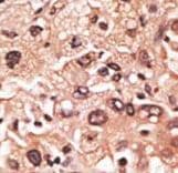 MAGEF1 Antibody (aa274-303)