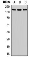 MAP3K5 / ASK1 Antibody (phospho-Ser966)