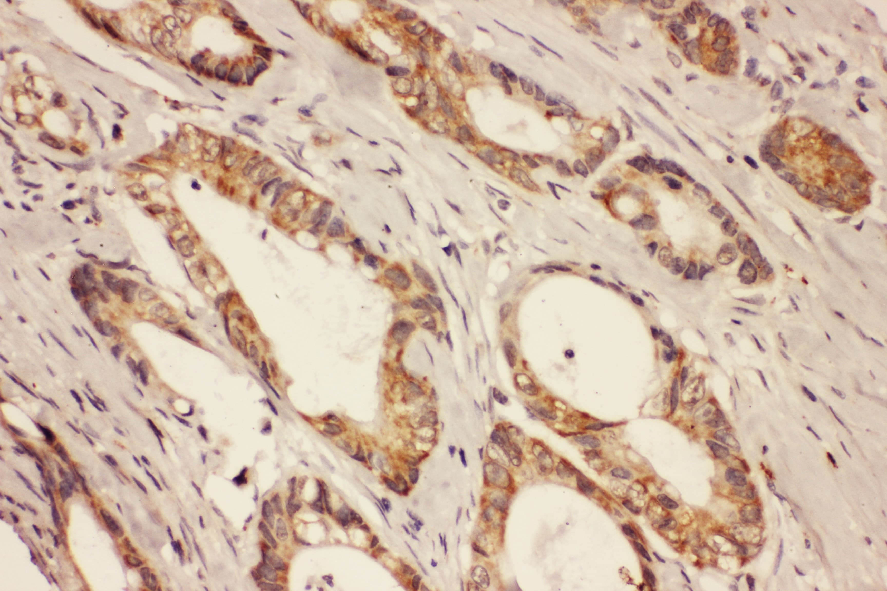 RAB8A / RAB8 Antibody (aa170-183)