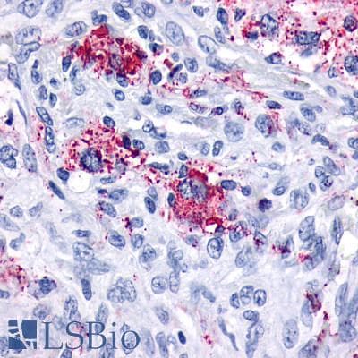 PathPlus™ Polyclonal Rabbit anti-Human GPR161 Antibody (C-Terminus, IHC)