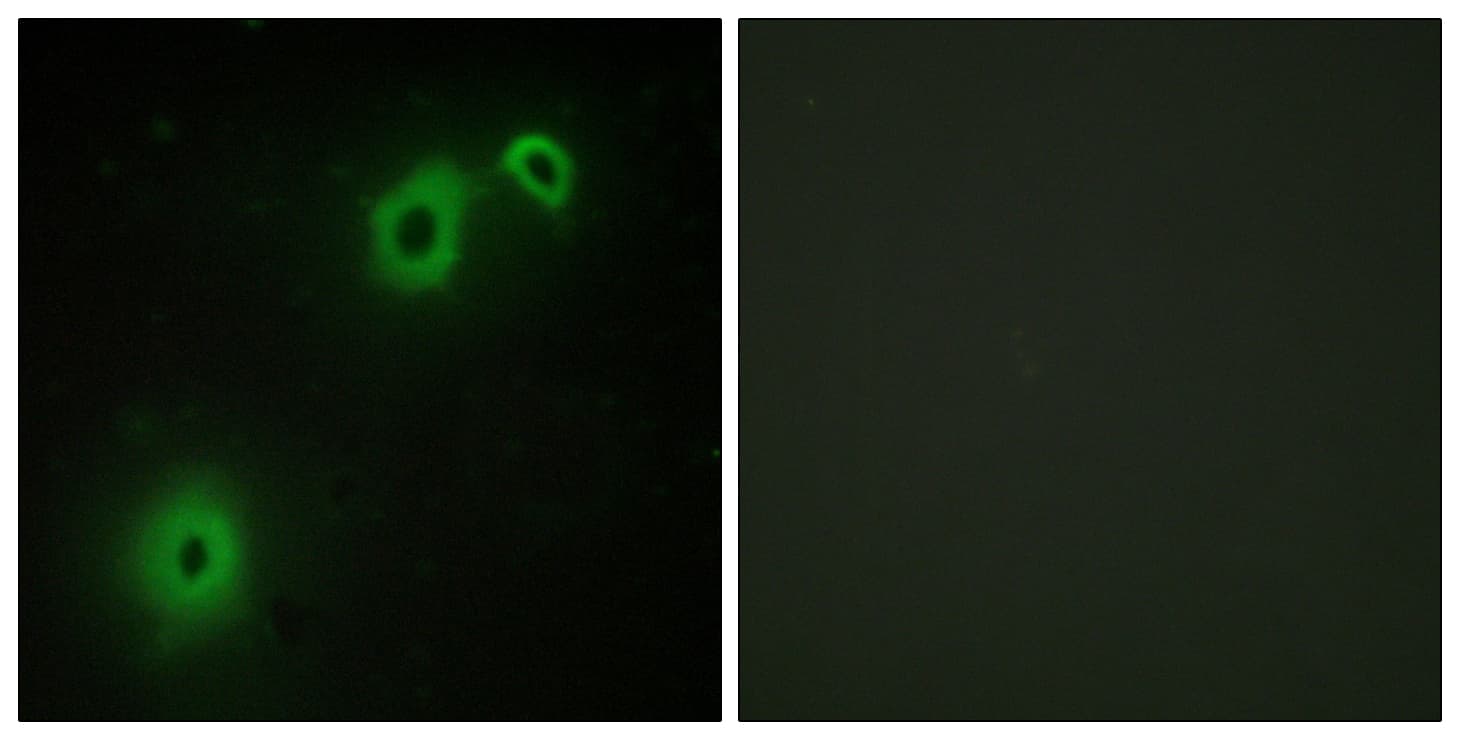 NGFR / CD271 / TNR16 Antibody (aa121-170)