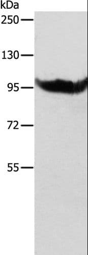Polyclonal Rabbit anti-Human AARS2 Antibody (IHC, WB)