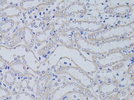 AQP5 / Aquaporin 5 Antibody