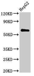 Polyclonal Rabbit anti-Human CTP Synthetase 2 / CTPS2 Antibody