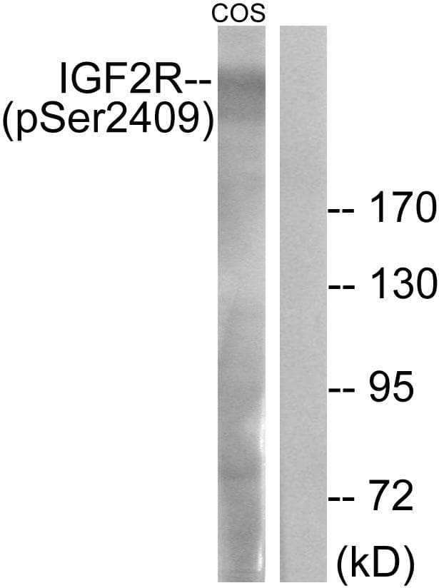 IGF2R / CD222 Antibody (phospho-Ser2409)