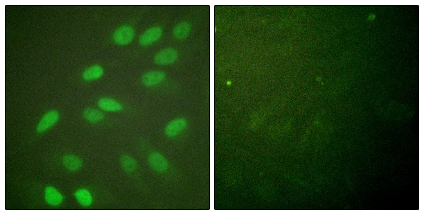 LMNA / Lamin A+C Antibody (p392)