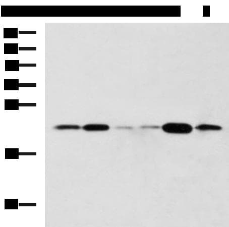 TMED10 / TMP21 Antibody