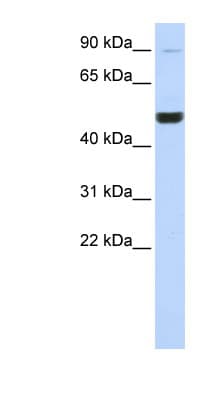 Polyclonal Rabbit anti-Human KIF2A Antibody (C-Terminus, WB)