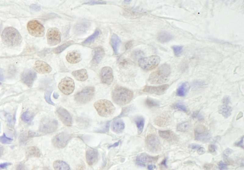 BCAS3 Antibody (aa870-C-term)