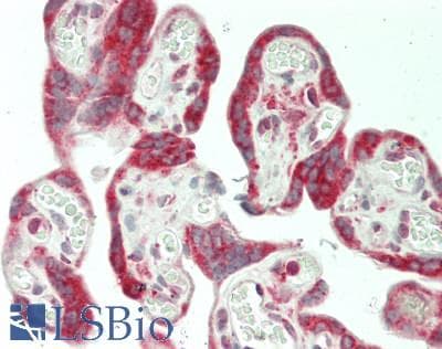 IHC-plus™ Polyclonal Rabbit anti-Human BMP5 Antibody (Internal, IHC, WB)