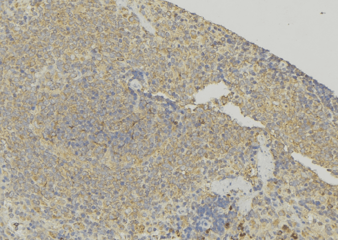 TAGLN2 / Transgelin 2 Antibody
